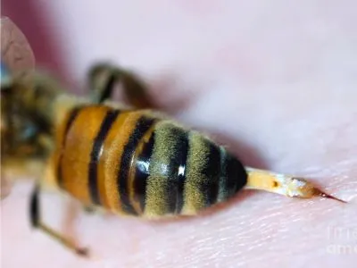 Bee Venom